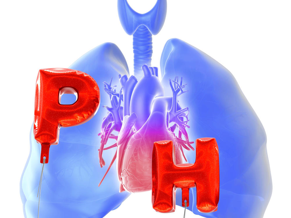 pulmonale Hypertonie