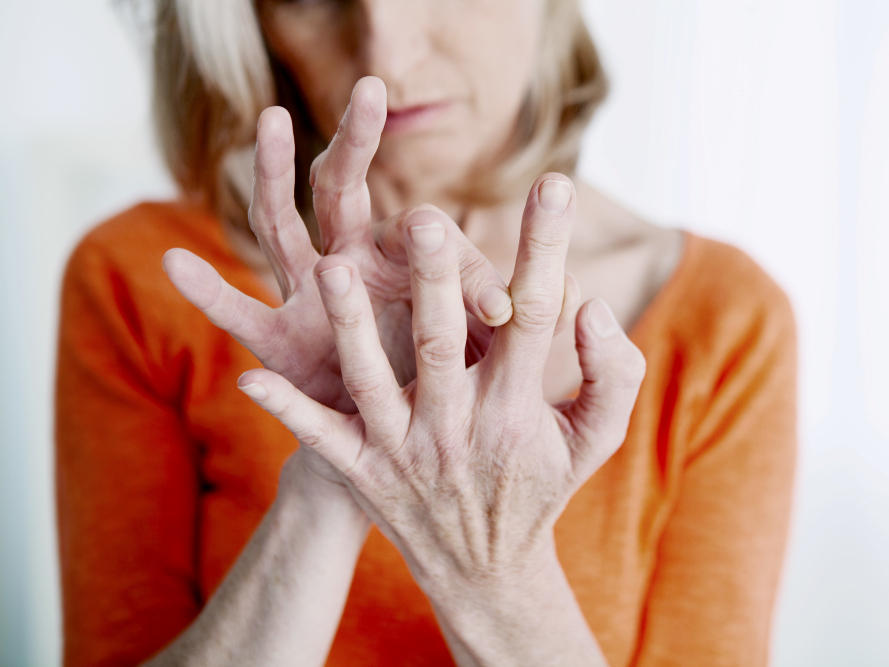 Frau mit rheumatoider Arthritis