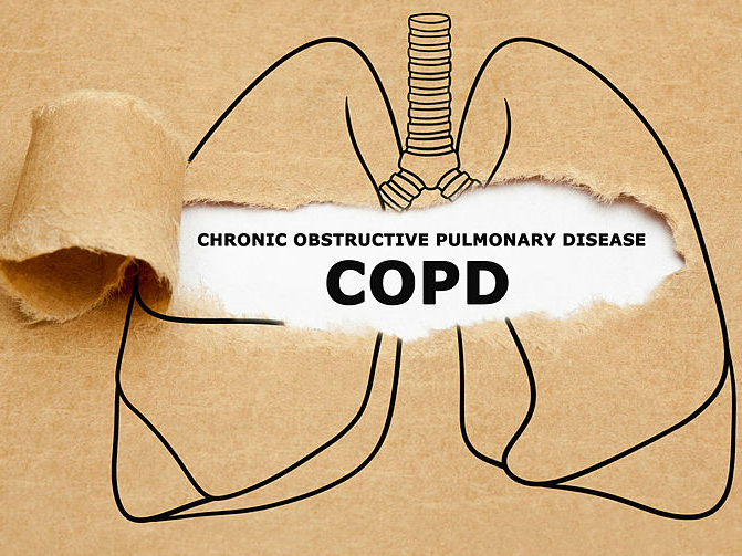 COPD